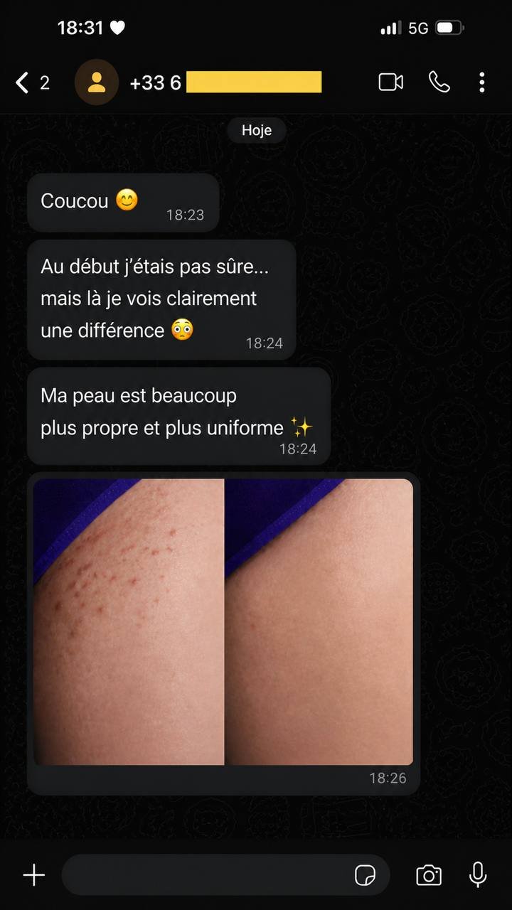 Témoignage 3